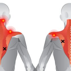 How can stiff and tight muscles result in back pain?